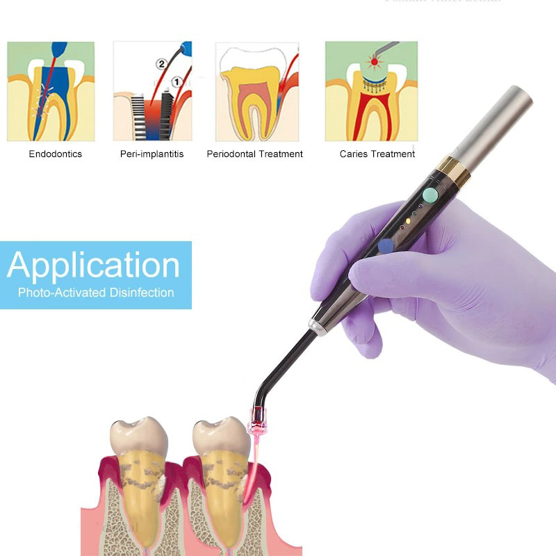 Wireless F3WW Dental Diode Las - Photography Lighting Studio recension och pris